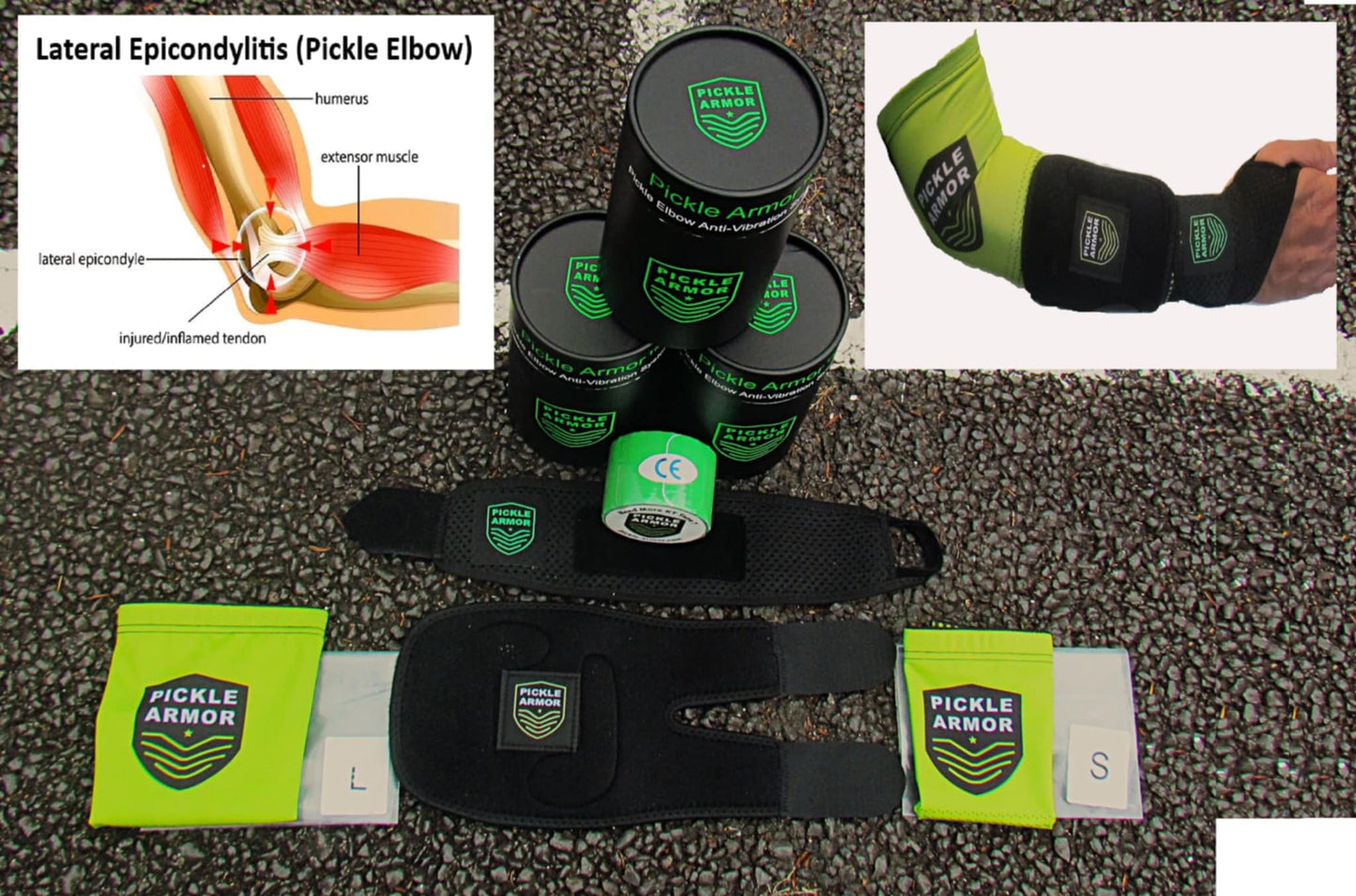 Pickle Armor Elbow System